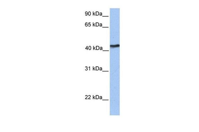 IGFLR1 Antibody in Western Blot (WB)