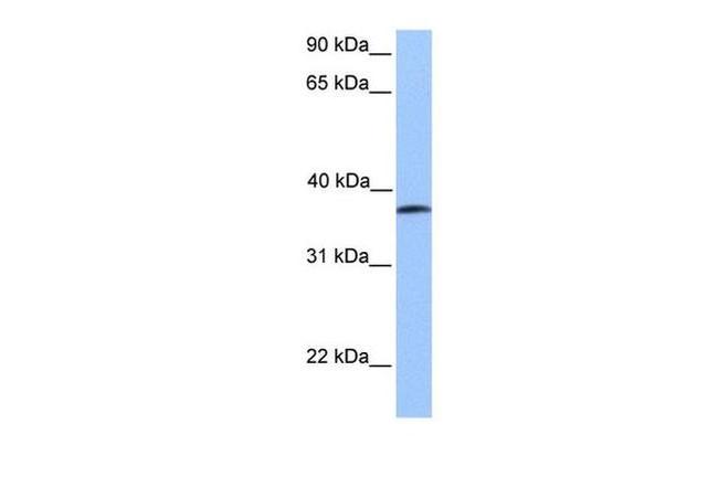 UBA5 Antibody in Western Blot (WB)