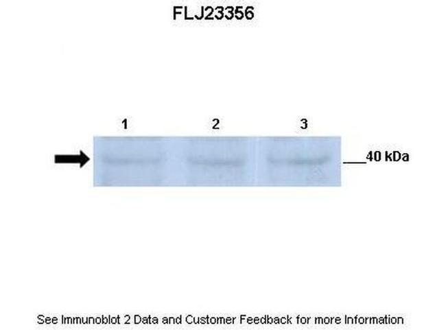 POMK Antibody in Western Blot (WB)