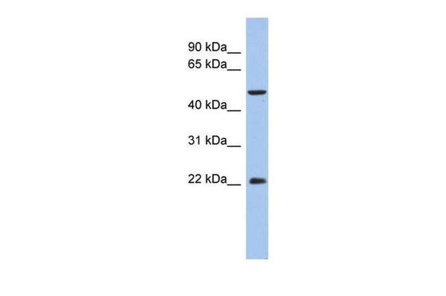 ANKH Antibody in Western Blot (WB)