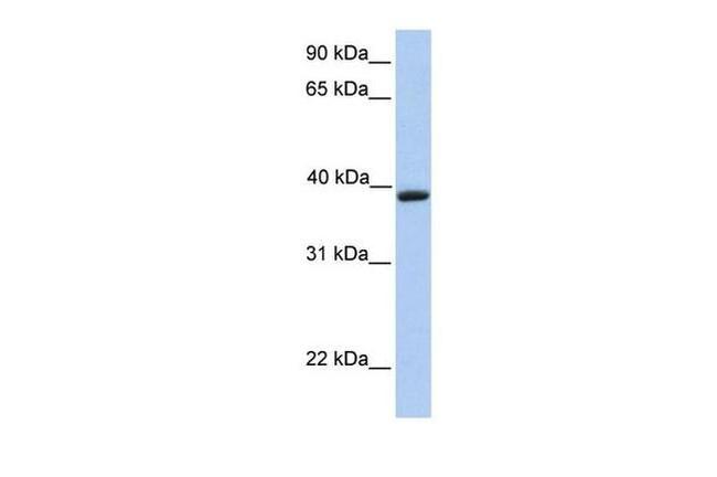 Aquaporin 10 Antibody in Western Blot (WB)