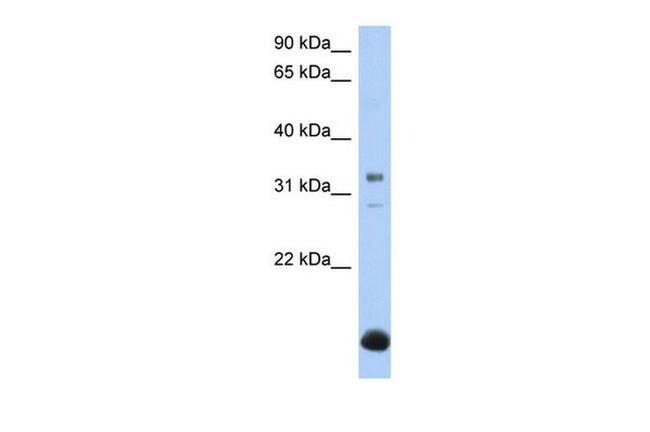 B3GALT6 Antibody in Western Blot (WB)