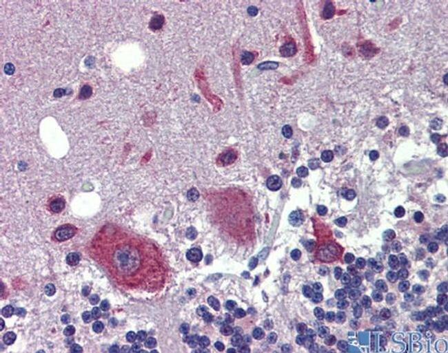 FEZF1 Antibody in Immunohistochemistry (IHC)