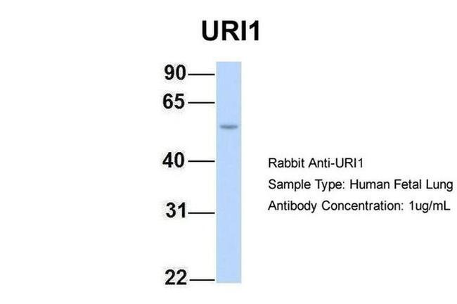 RMP Antibody in Western Blot (WB)