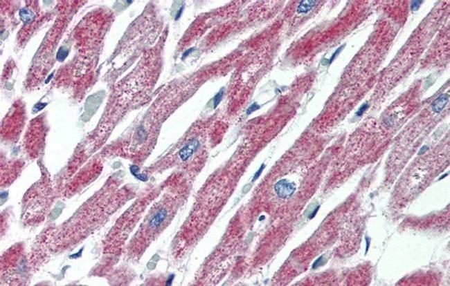 MAS1 Antibody in Immunohistochemistry (IHC)