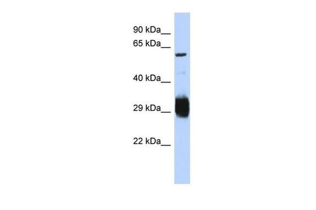 SETMAR Antibody in Western Blot (WB)