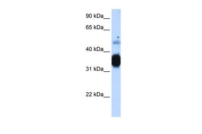 TNNT3 Antibody in Western Blot (WB)