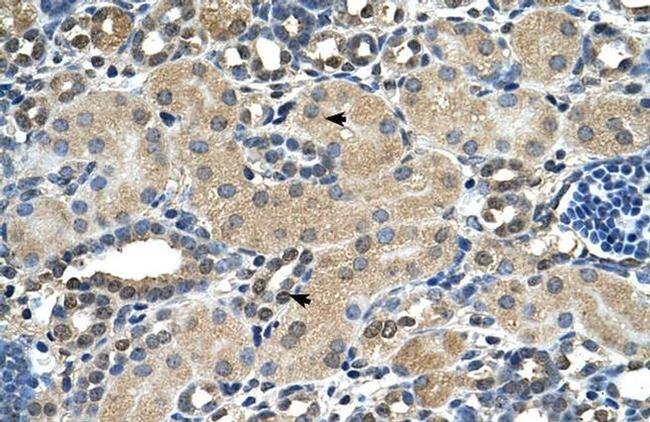 ASPH Antibody in Immunohistochemistry (IHC)