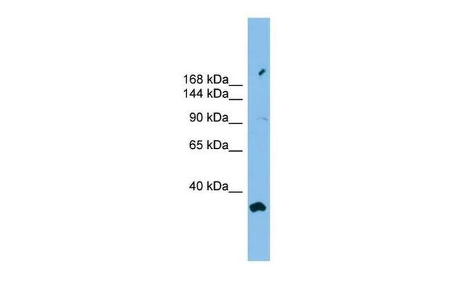 PACS2 Antibody in Western Blot (WB)