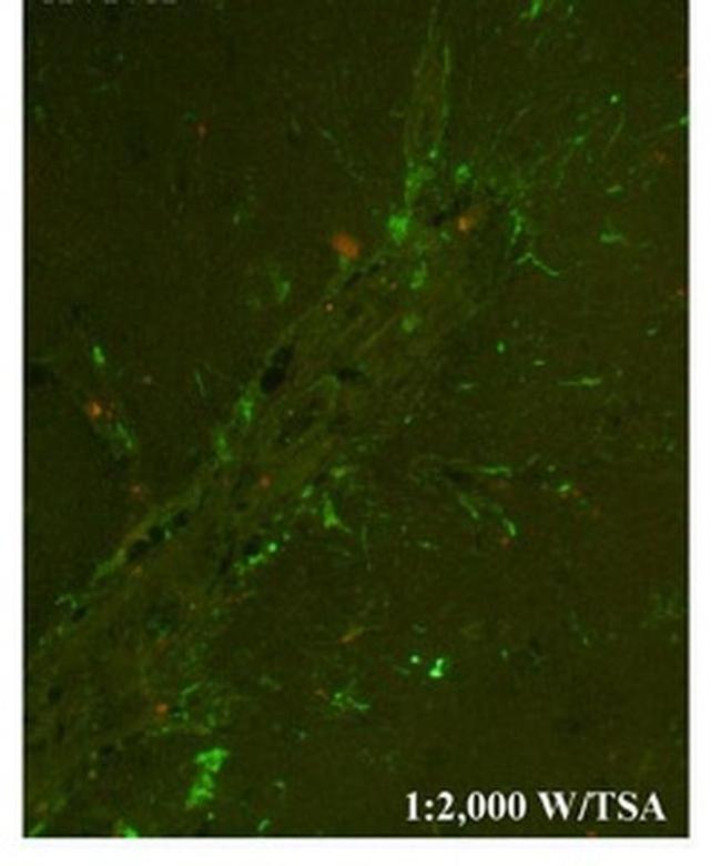 CHI3L1 Antibody in Immunocytochemistry (ICC/IF)