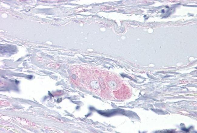 DPYSL3 Antibody in Immunohistochemistry (IHC)