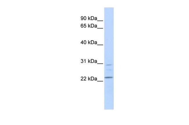 LYPLA1 Antibody in Western Blot (WB)