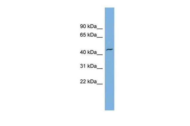 VAT1 Antibody in Western Blot (WB)