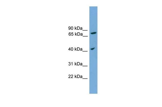 SPPL3 Antibody in Western Blot (WB)