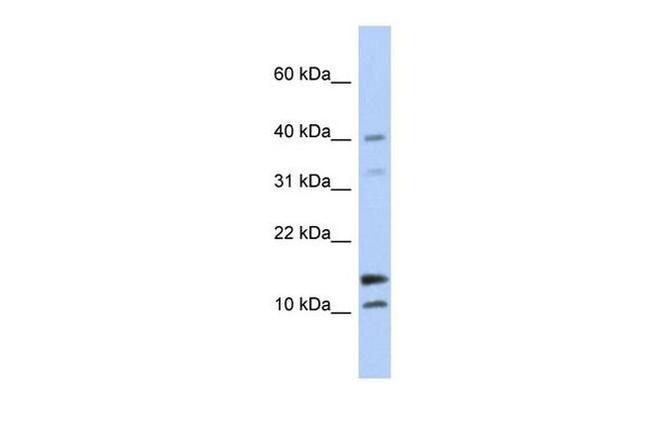 WFDC5 Antibody in Western Blot (WB)