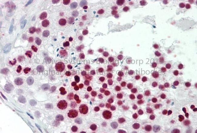 TNP1 Antibody in Immunohistochemistry (Paraffin) (IHC (P))