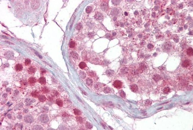 IFT88 Antibody in Immunohistochemistry (IHC)