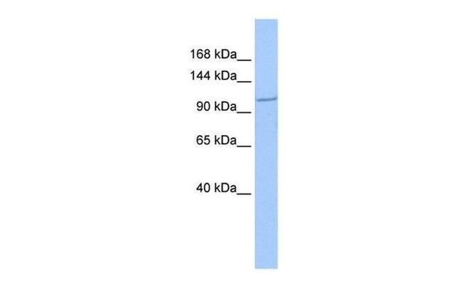 IFT122 Antibody in Western Blot (WB)