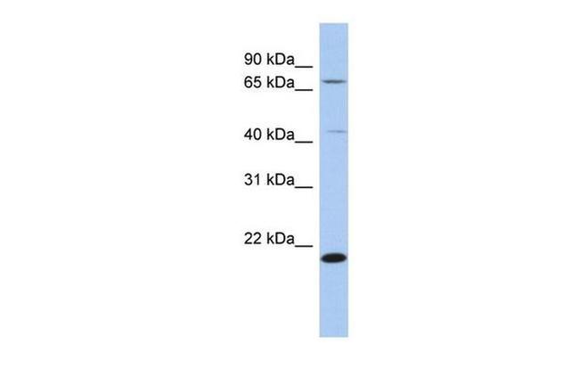 AMD1 Antibody in Western Blot (WB)