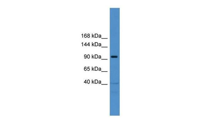 TRAK1 Antibody in Western Blot (WB)