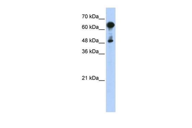 HSPA6 Antibody in Western Blot (WB)