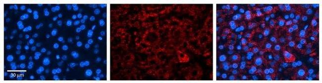 ICA1 Antibody in Immunohistochemistry (Paraffin) (IHC (P))