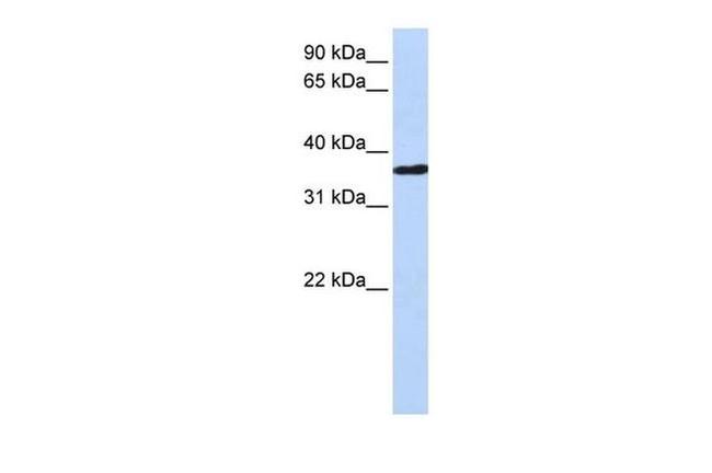 CHORDC1 Antibody in Western Blot (WB)