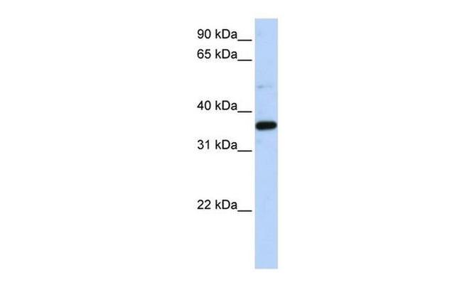 PTGR1 Antibody in Western Blot (WB)