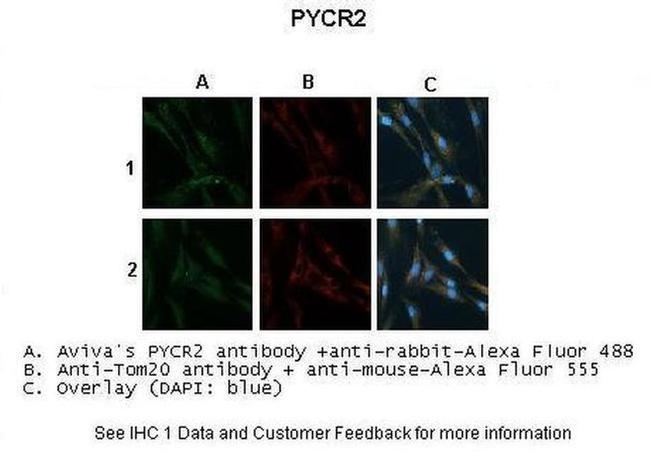 PYCR2 Antibody in Immunocytochemistry (ICC/IF)