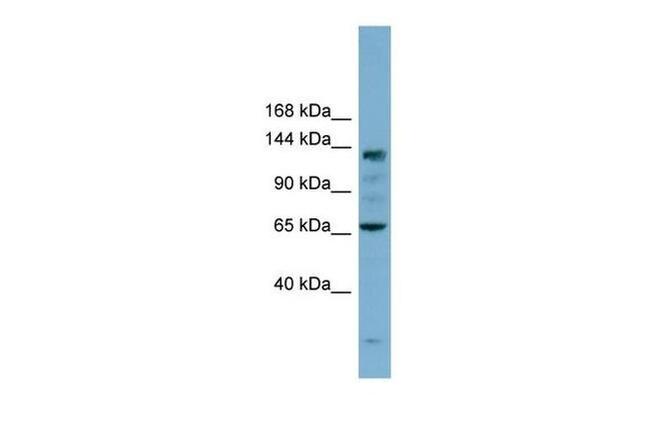 IARS Antibody in Western Blot (WB)