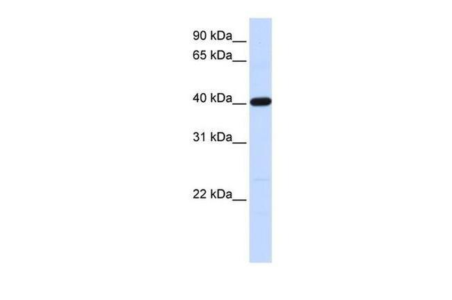 TMOD3 Antibody in Western Blot (WB)