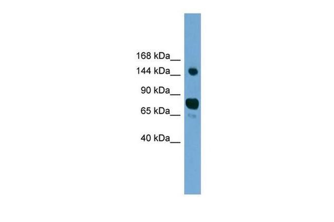 AGTPBP1 Antibody in Western Blot (WB)