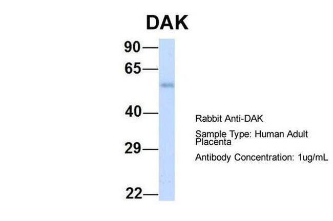 DAK Antibody in Western Blot (WB)