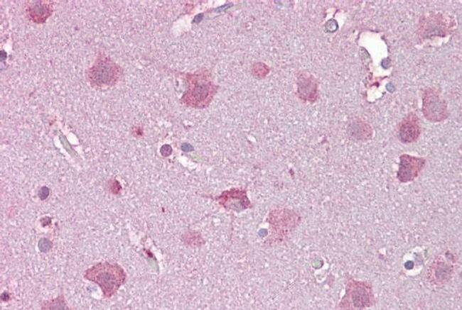 NDP Antibody in Immunohistochemistry (IHC)