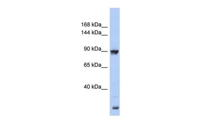 URG4 Antibody in Western Blot (WB)