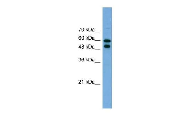 PGM1 Antibody in Western Blot (WB)