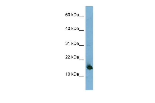 MED31 Antibody in Western Blot (WB)