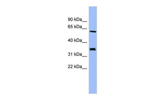 HECA Antibody in Western Blot (WB)