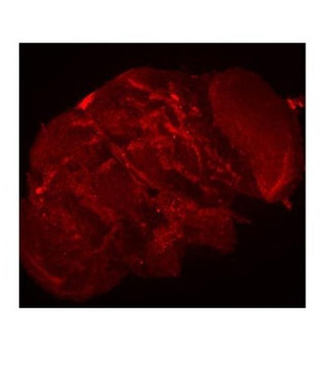 TUBE1 Antibody in Immunohistochemistry (IHC)