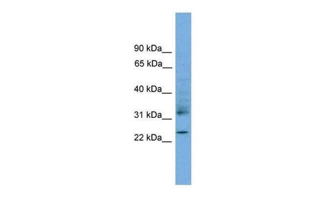 RhoJ Antibody in Western Blot (WB)