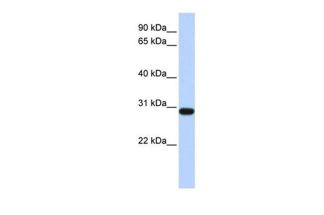 Bisphosphoglycerate mutase Antibody in Western Blot (WB)