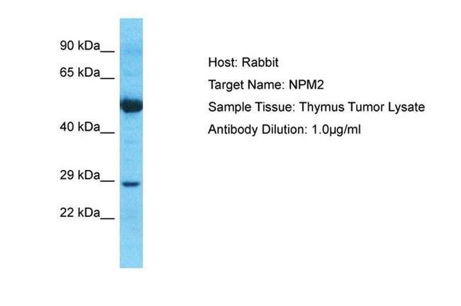 NPM2 Antibody in Western Blot (WB)