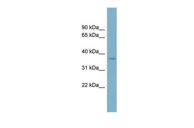 SPAG4L Antibody in Western Blot (WB)