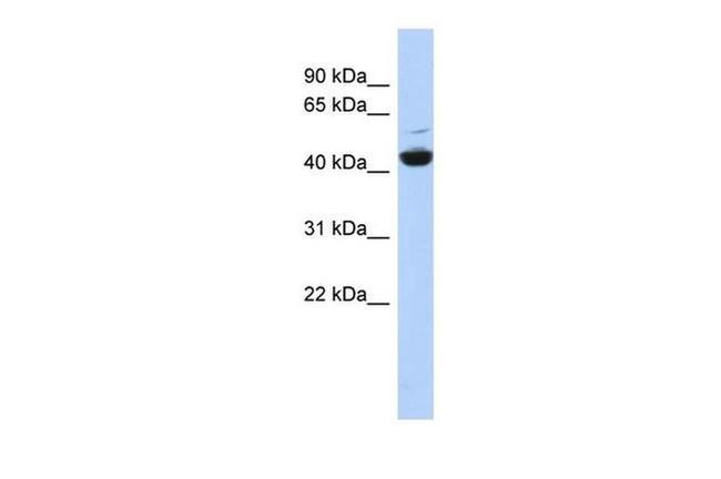 V-ATPase C1 Antibody in Western Blot (WB)