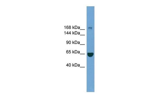 ZCCHC11 Antibody in Western Blot (WB)