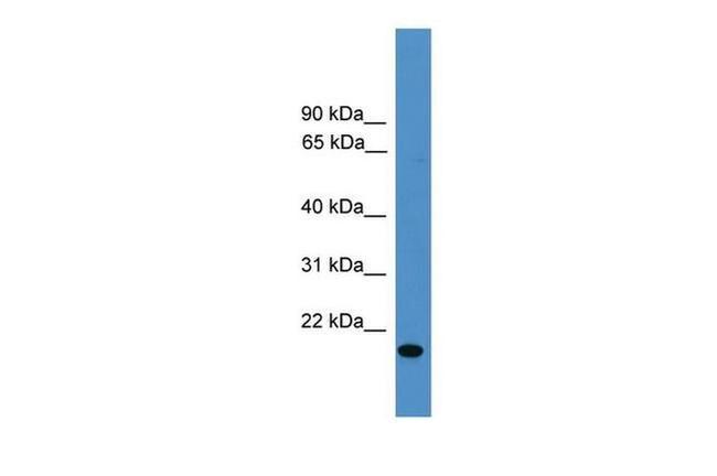 VEGFB Antibody in Western Blot (WB)