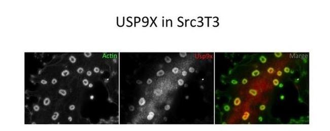 USP9X Antibody in Immunocytochemistry (ICC/IF)