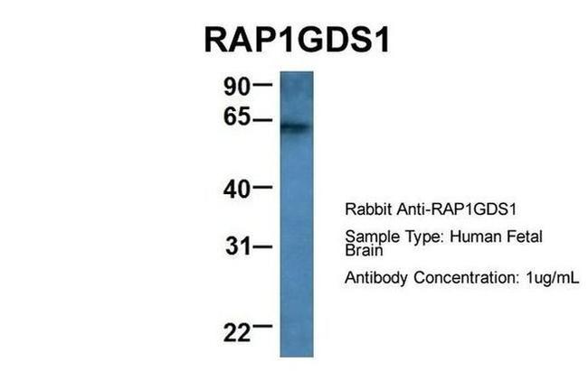 RAP1GDS1 Antibody in Western Blot (WB)