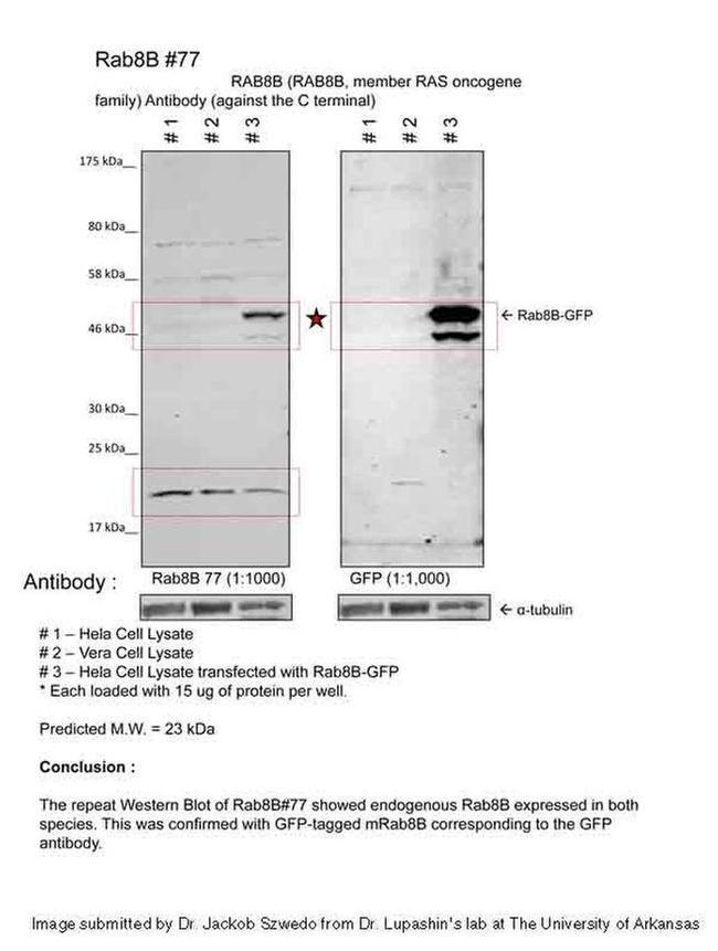 RAB8B Antibody in Western Blot (WB)