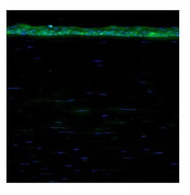 ALDH3A1 Antibody in Immunohistochemistry (IHC)